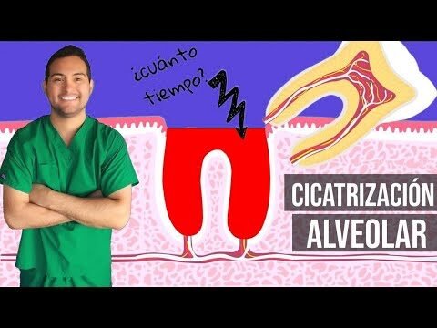 Consejos para cuidar la cicatriz después de la extracción de muela