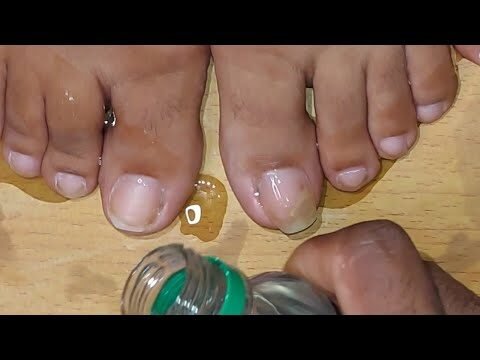 Beneficios del aceite de coco para las uñas de los pies